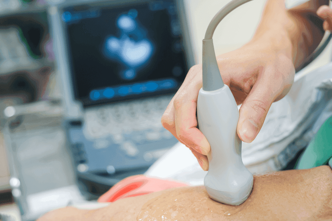 Hypertension: The Silent Threat to Cardiovascular Health