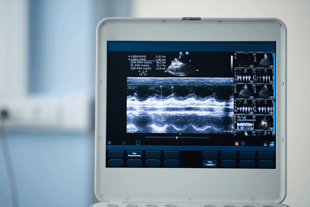 New Oral Anticoagulants (NOACs) and Cardiology