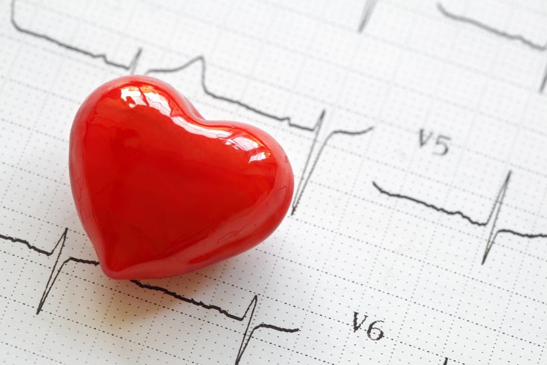 Electrocardiogram